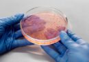 Klebsiella pneumoniae: Θανατηφόρο ανθεκτικό βακτήριο που εξαπλώνεται στην Ευρώπη