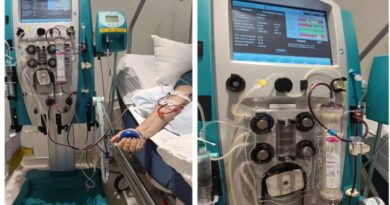 Πλασμαφαίρεση: Τι είναι, πώς γίνεται και πότε χρησιμοποιείται – Τι πρέπει να γνωρίζουμε